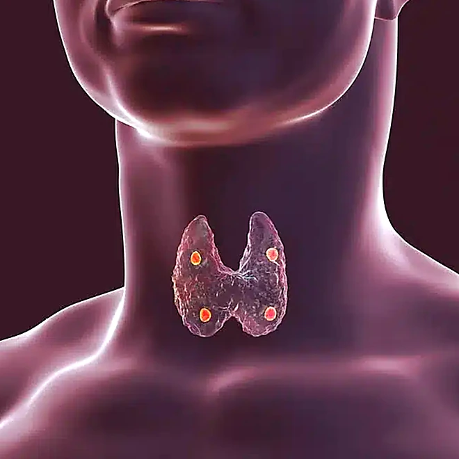 Medical illustration of the thyroid gland in the neck, the gland managed in thyroid care at Elite Health and Wellness Center